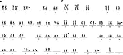 Differential prognostic impact of stratified additional chromosome abnormalities on disease progression among Malaysian chronic myeloid leukemia patients undergoing treatment with imatinib mesylate